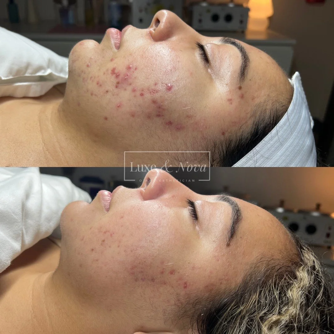 Luxe and Nova Before and After 13.jpeg