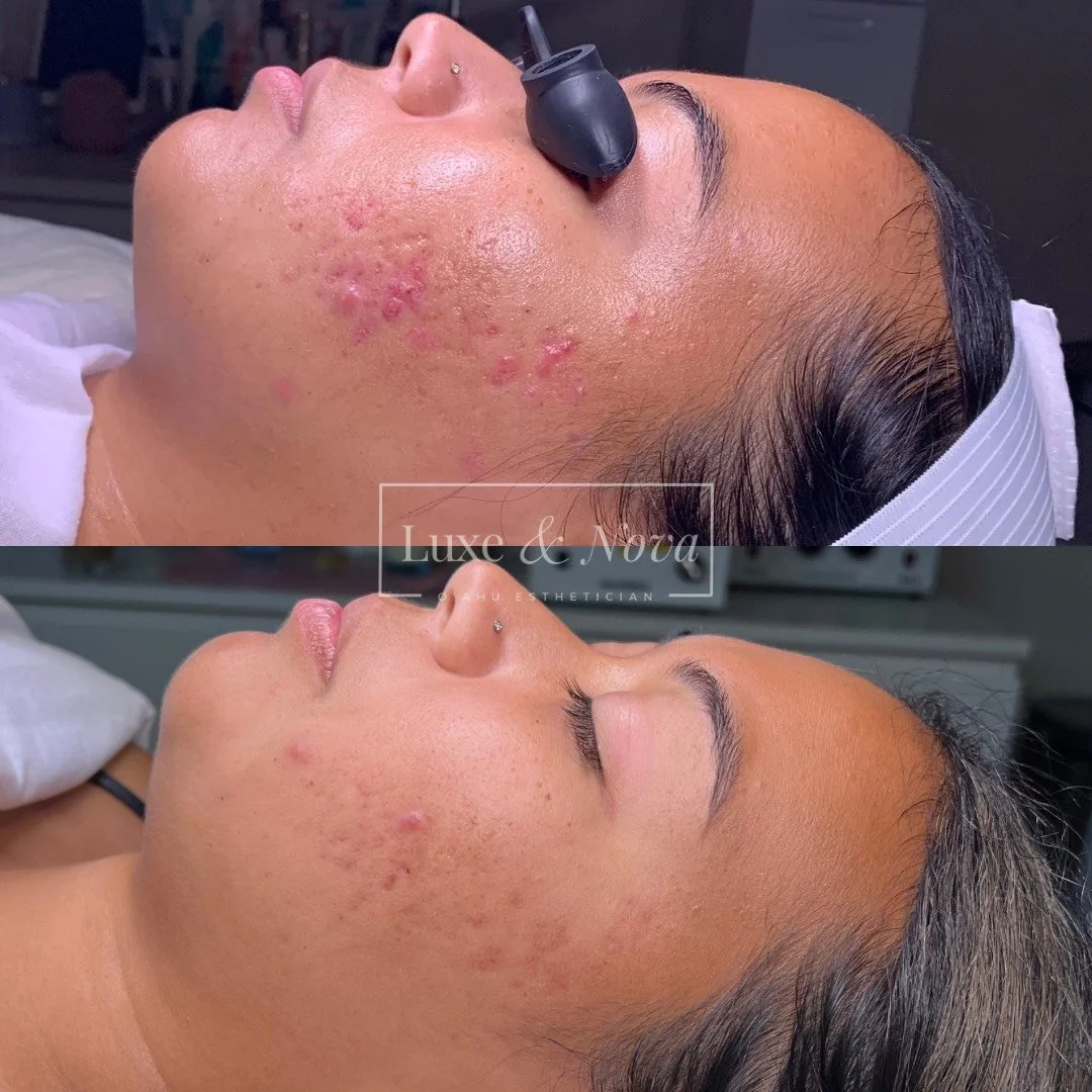 Luxe and Nova Before and After 14.jpeg