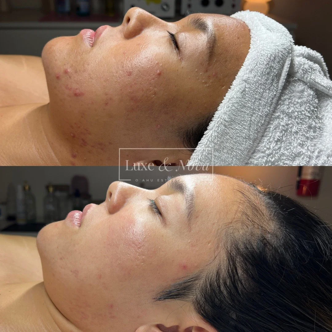 Luxe and Nova Before and After 15.jpeg