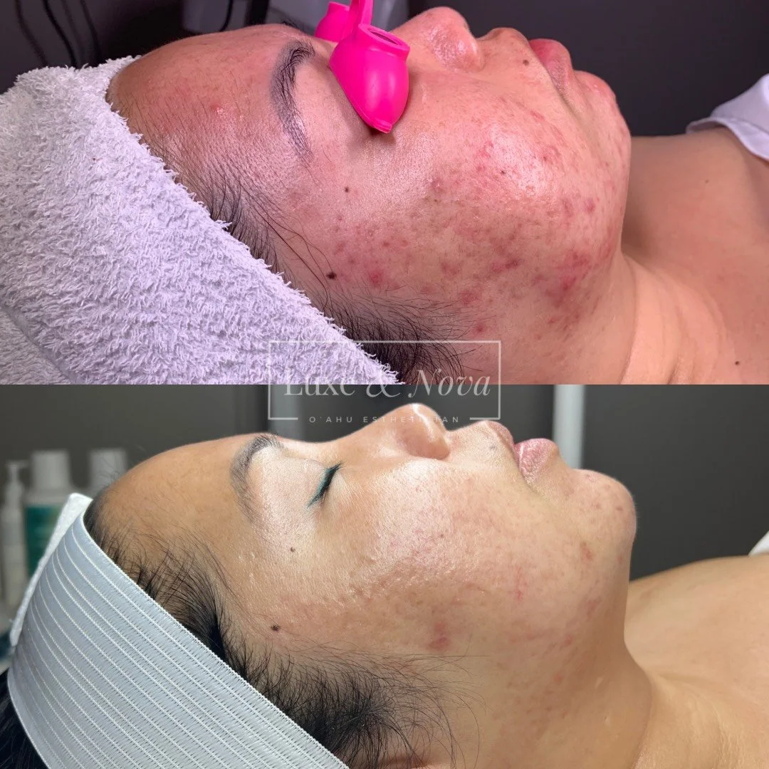 Luxe and Nova Before and After 16.jpeg