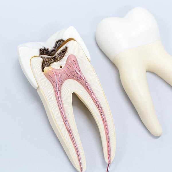 pic_endodontie.jpg