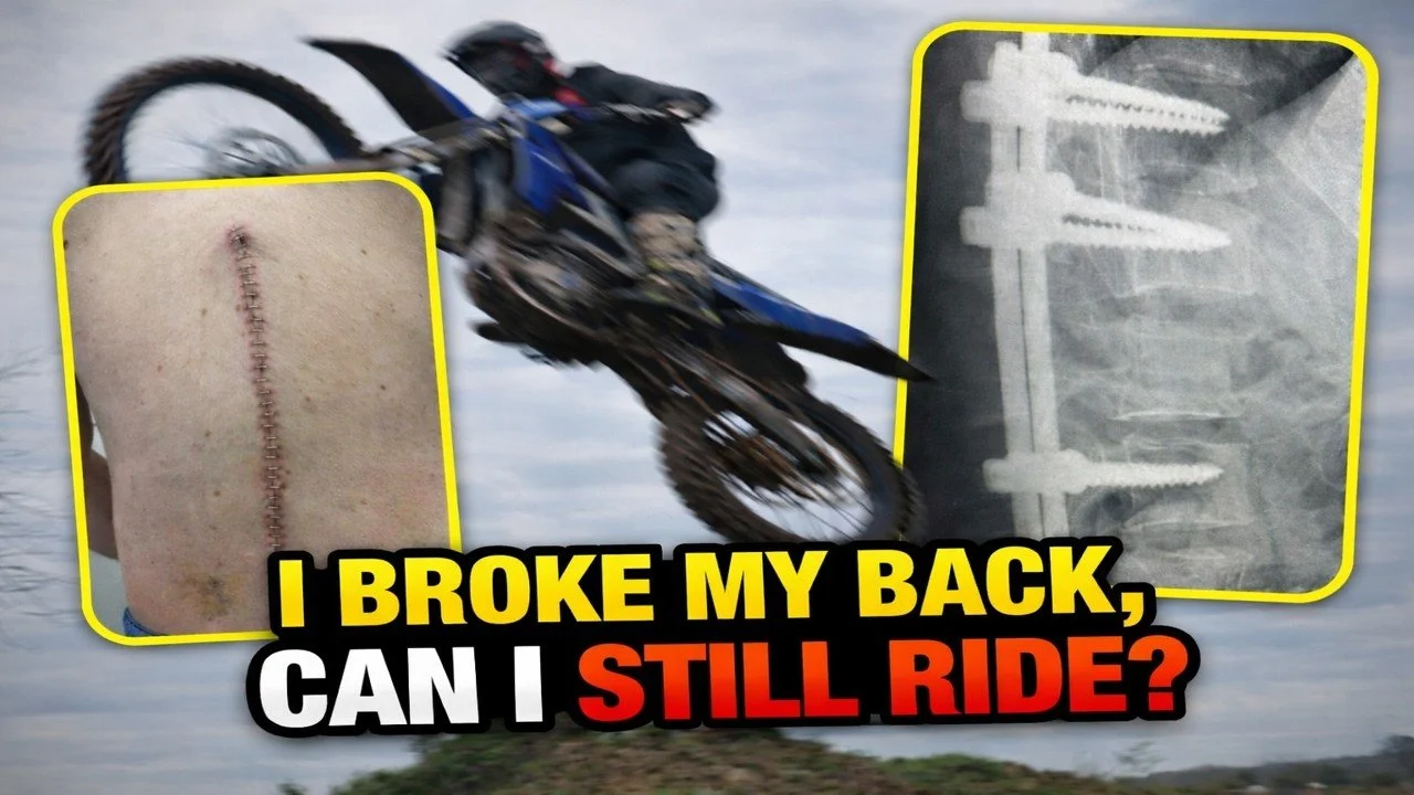 I broke my back… Can I still ride a MX bike?