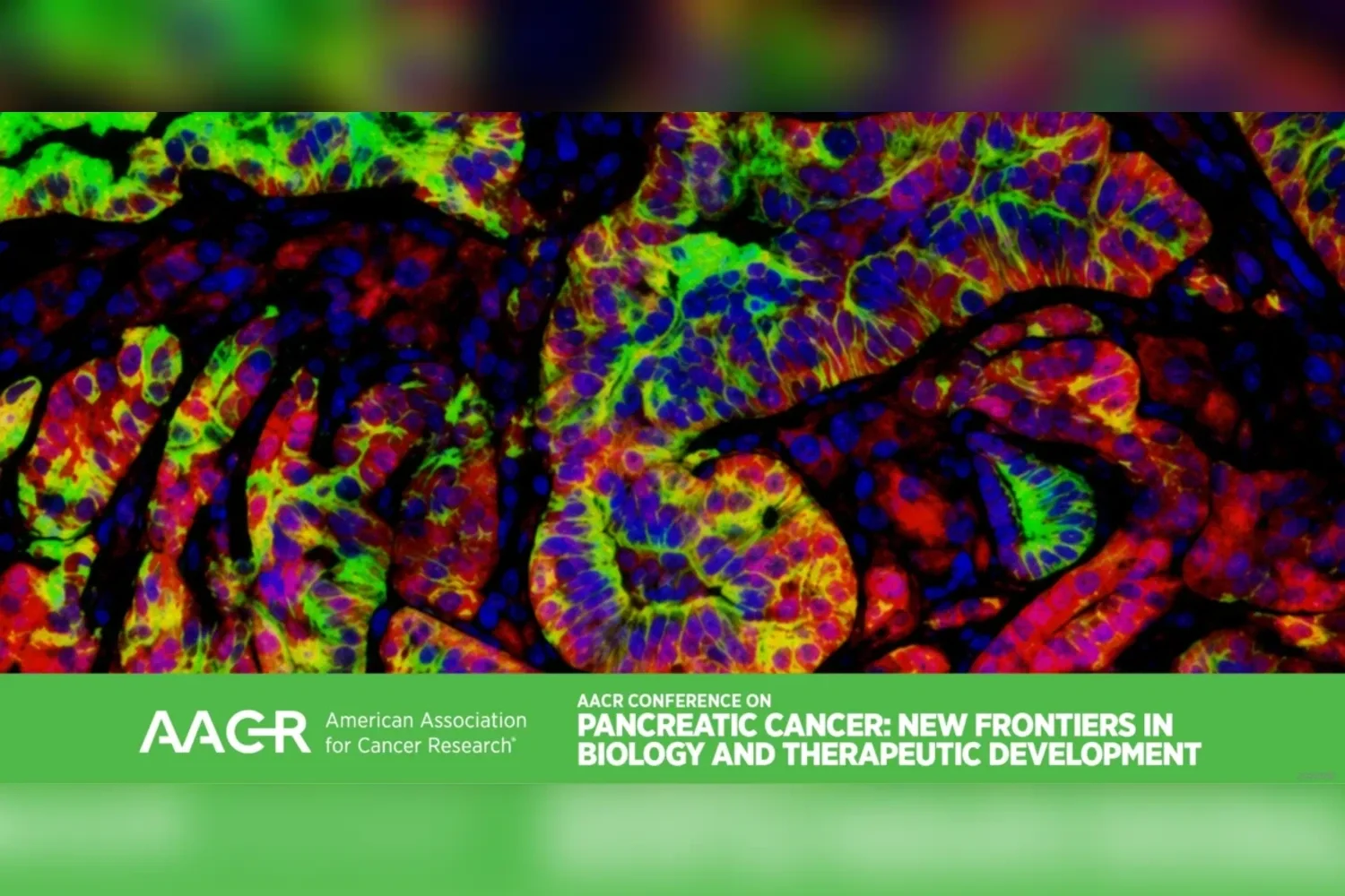 AACR Conference on Pancreatic Cancer: New Frontiers in Biology and Therapeutic Development
