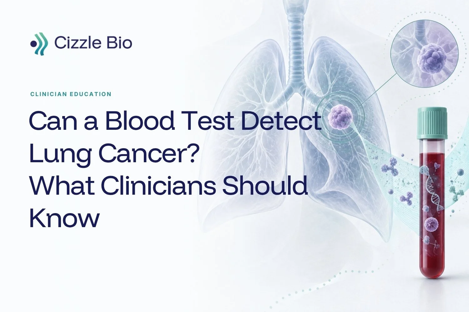 Can a blood test detect lung cancer? What clinicians should know