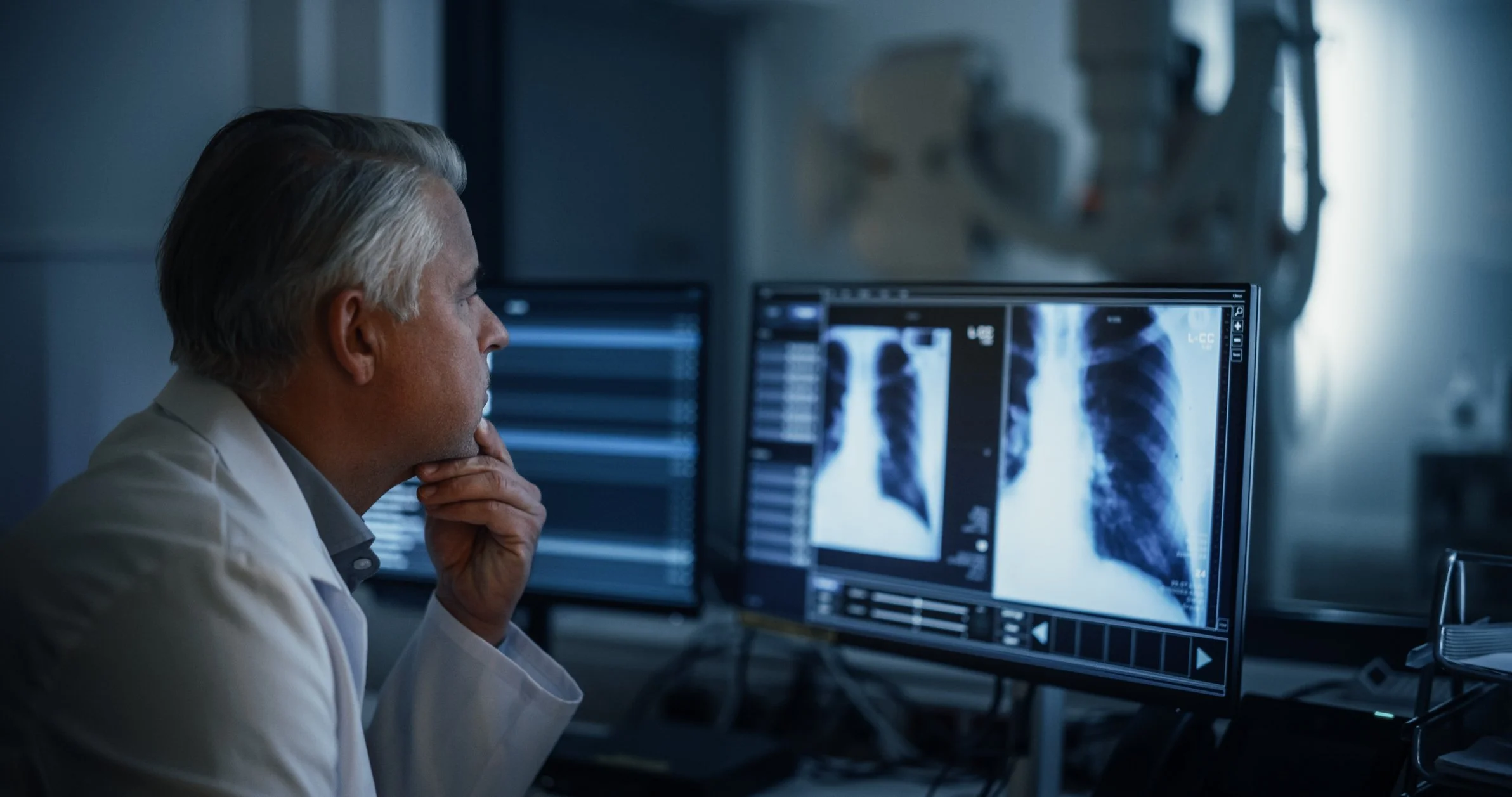 Clinician reviewing lung imaging on a computer, highlighting the importance of earlier lung cancer detection for timely treatment decisions.