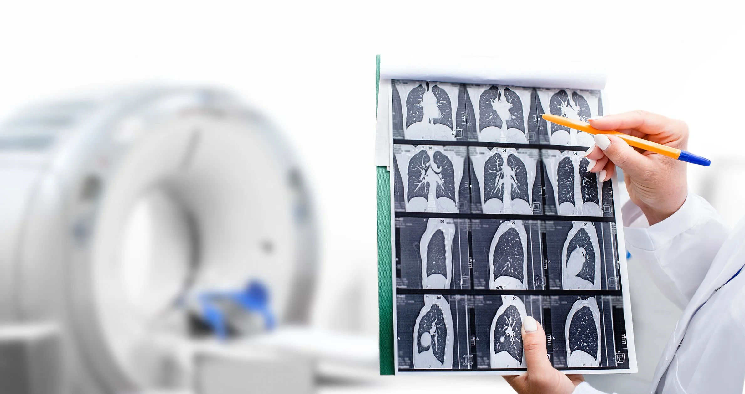 Healthcare provider reviewing chest CT lung scan images as part of a comprehensive lung cancer assessment alongside CIZ1B biomarker blood test results.