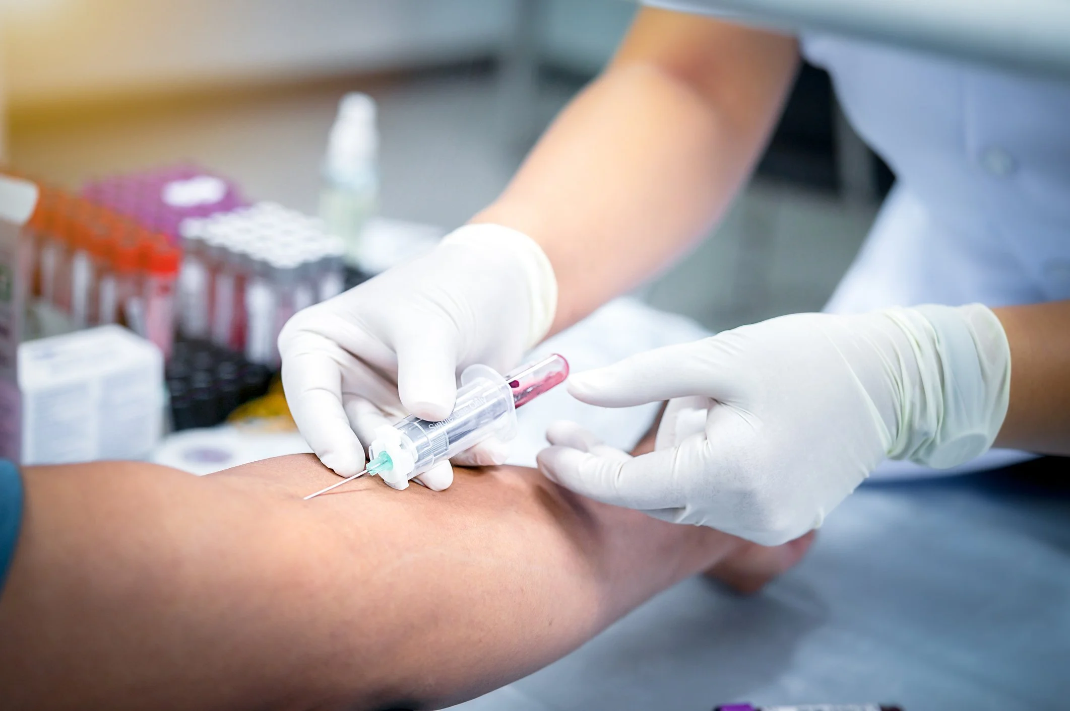 Gloved healthcare professional drawing a blood sample from a patient’s arm.