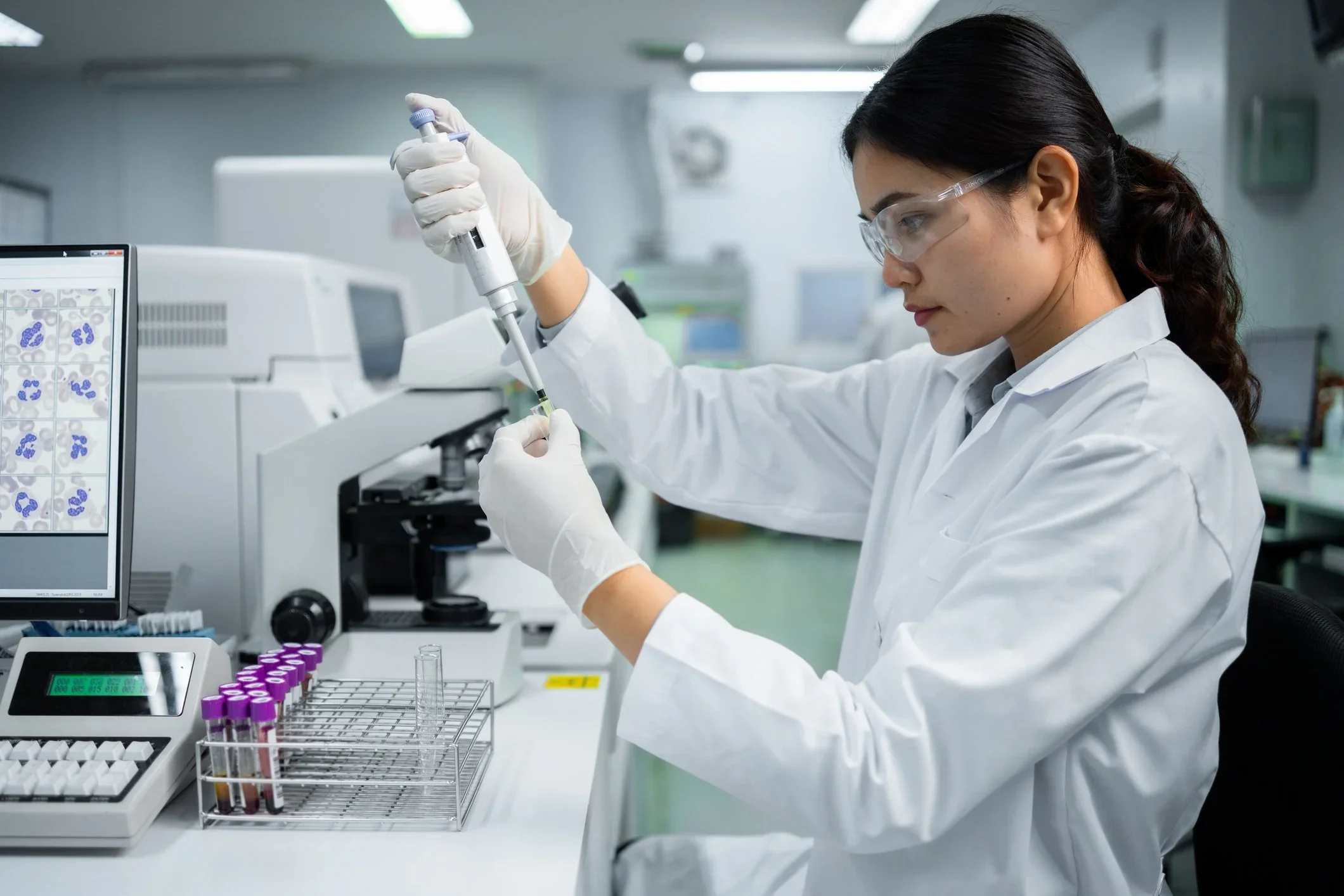 Laboratory technician testing blood samples for early lung cancer detection.