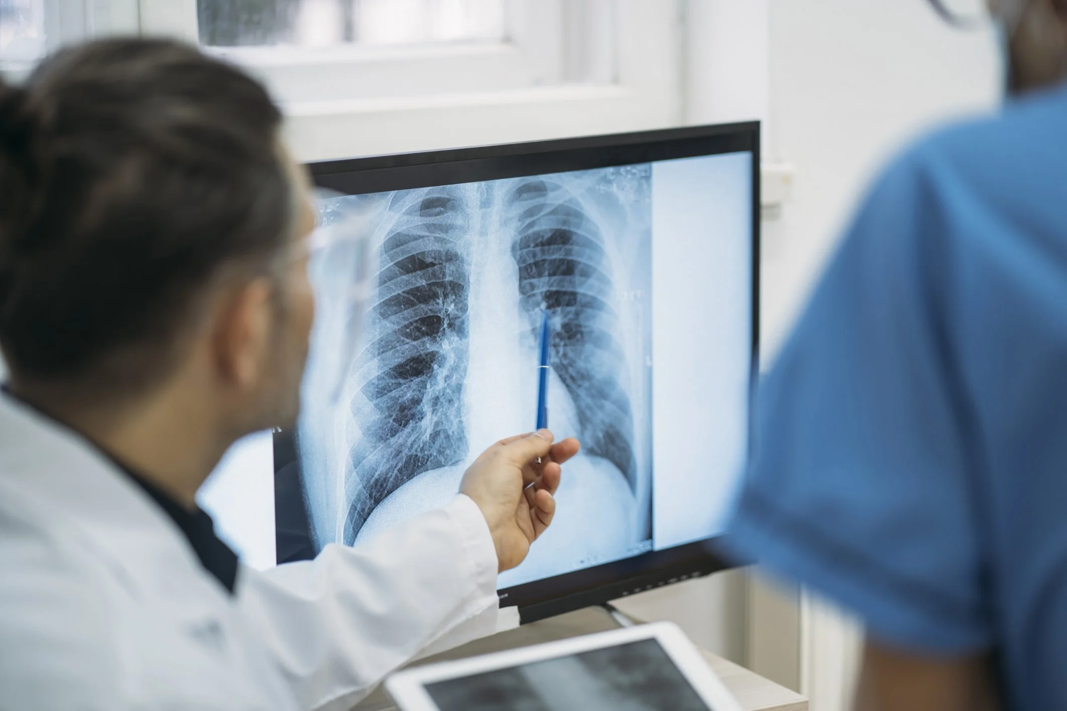 Doctor reviewing a lung scan as part of early lung cancer detection and screening.
