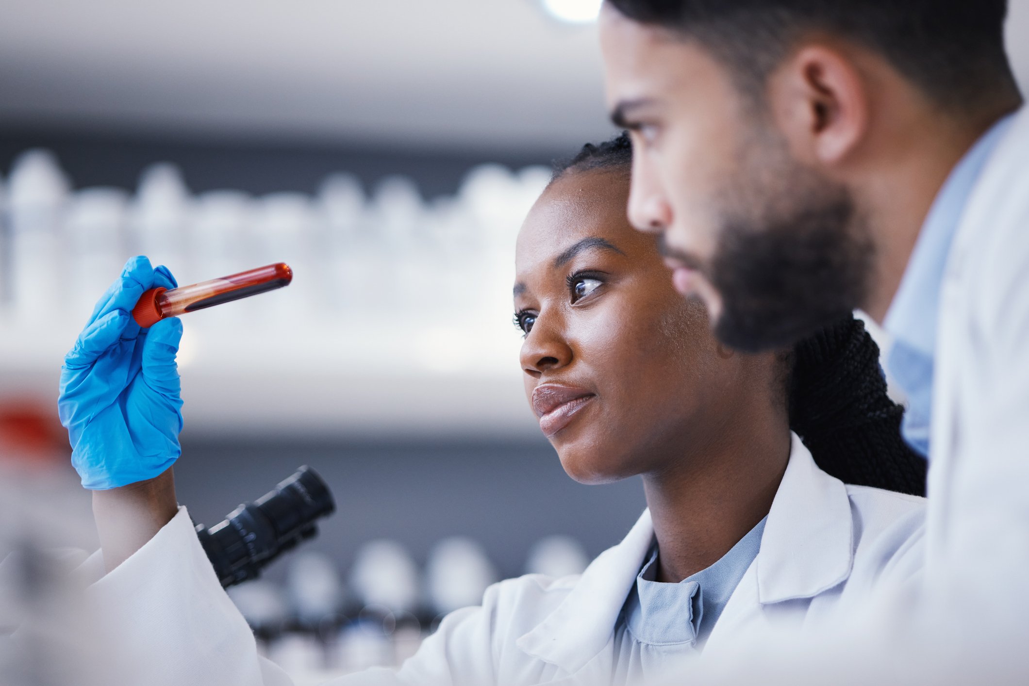 Blood sample tube in a laboratory representing CIZ1B biomarker testing for early lung cancer detection.
