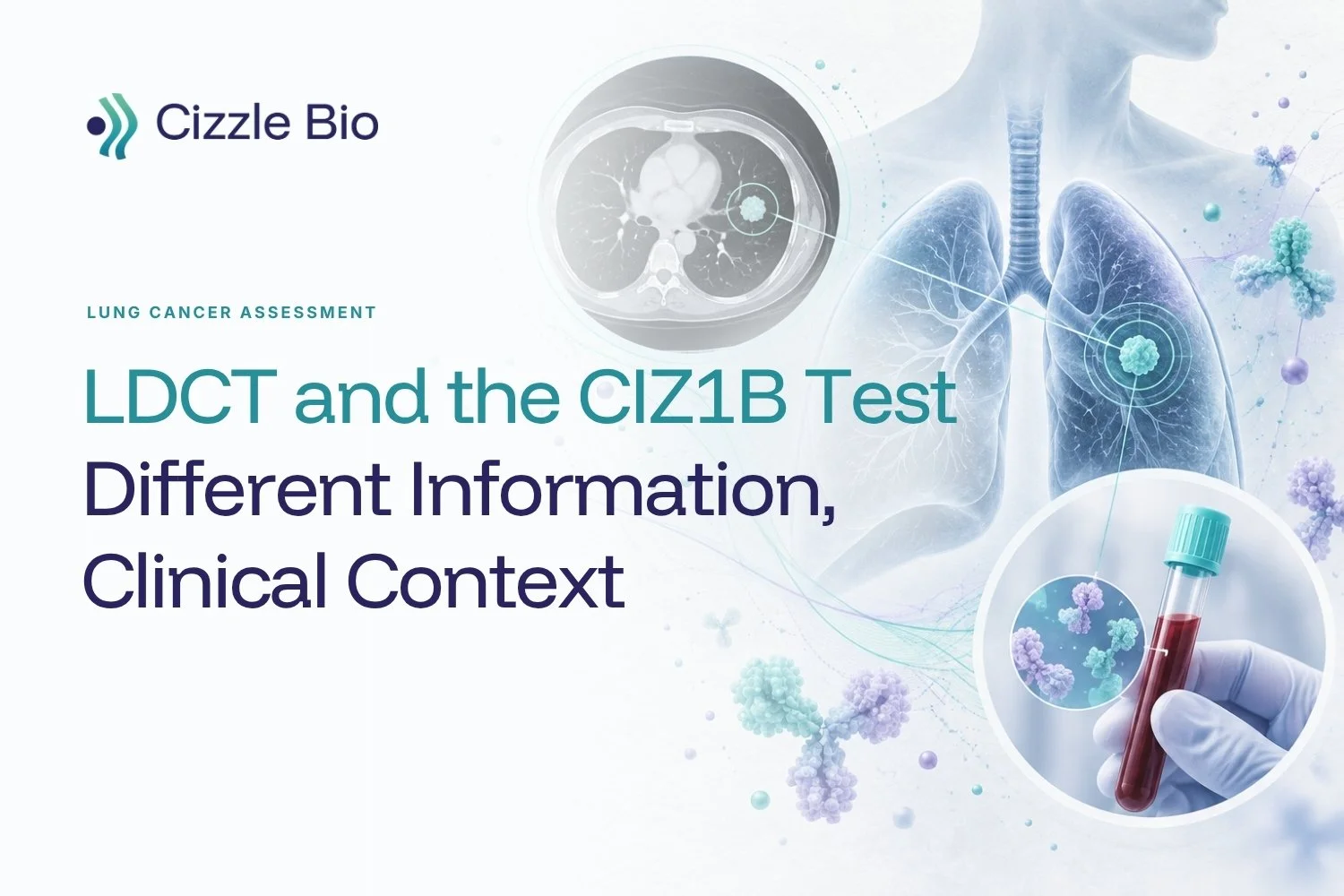Lung cancer screening: LDCT and the CIZ1B test in lung cancer assessment