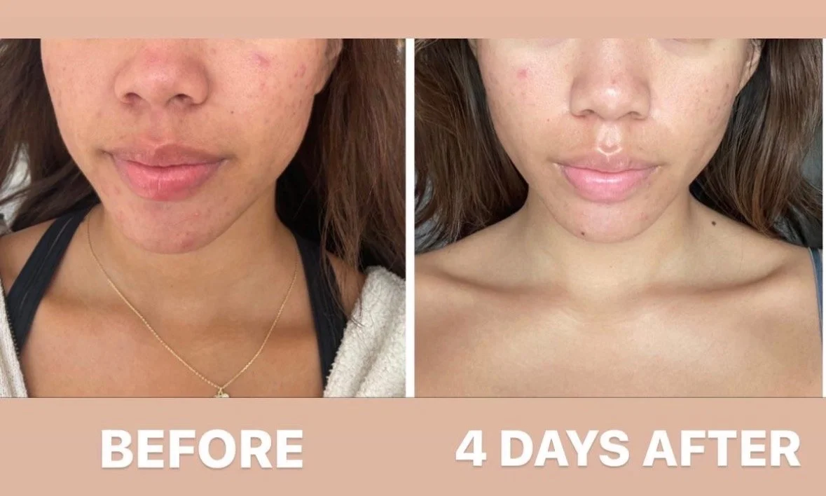 Medspa in Los Angeles, CA 90046 | Facials Near Me