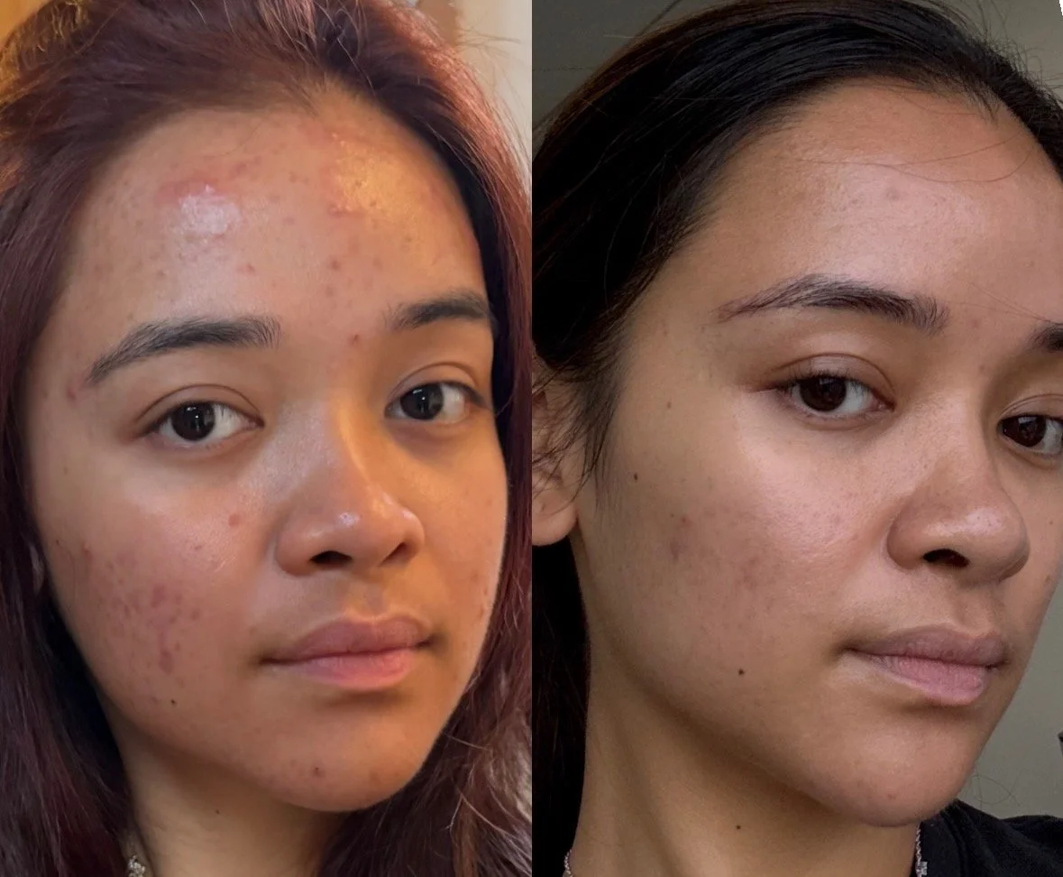 Medspa in Los Angeles, CA 90046 | Facials Near Me