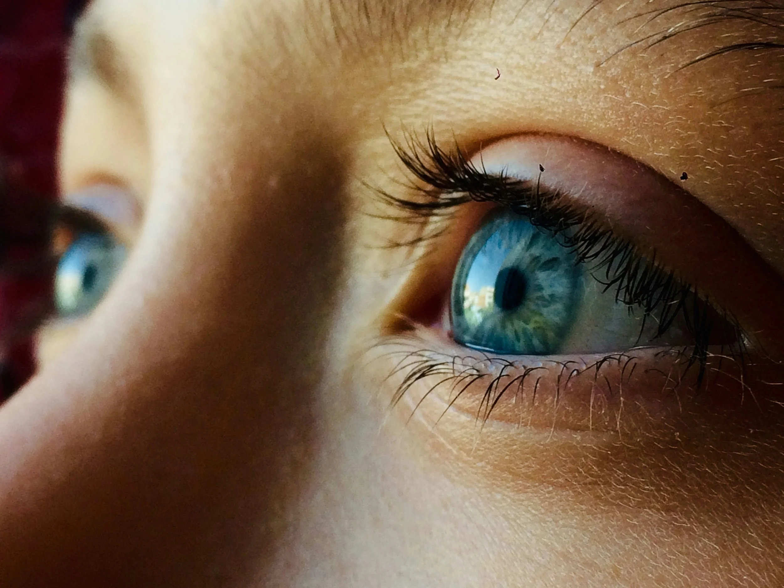 Dry Eye Treatment Los Angeles Eye Spa Optometry 8022 Melrose Ave Los angeles 90046