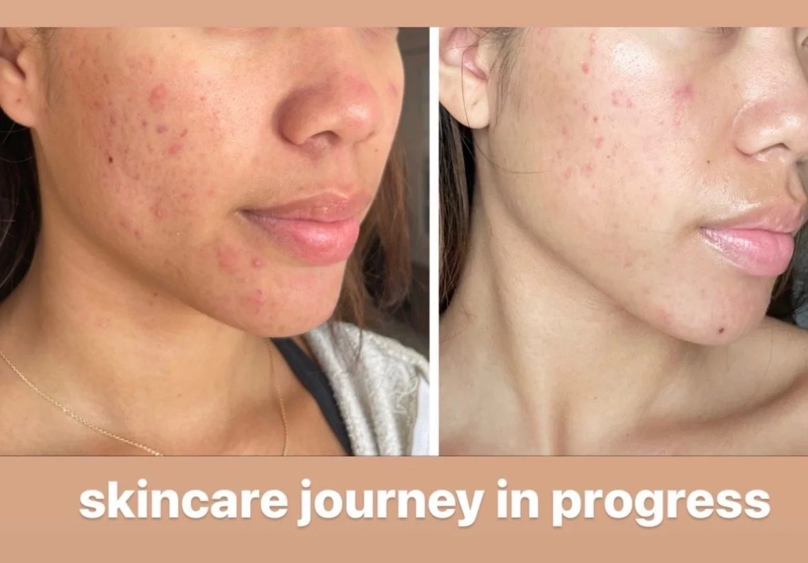 Medspa in Los Angeles, CA 90046 | Facials Near Me