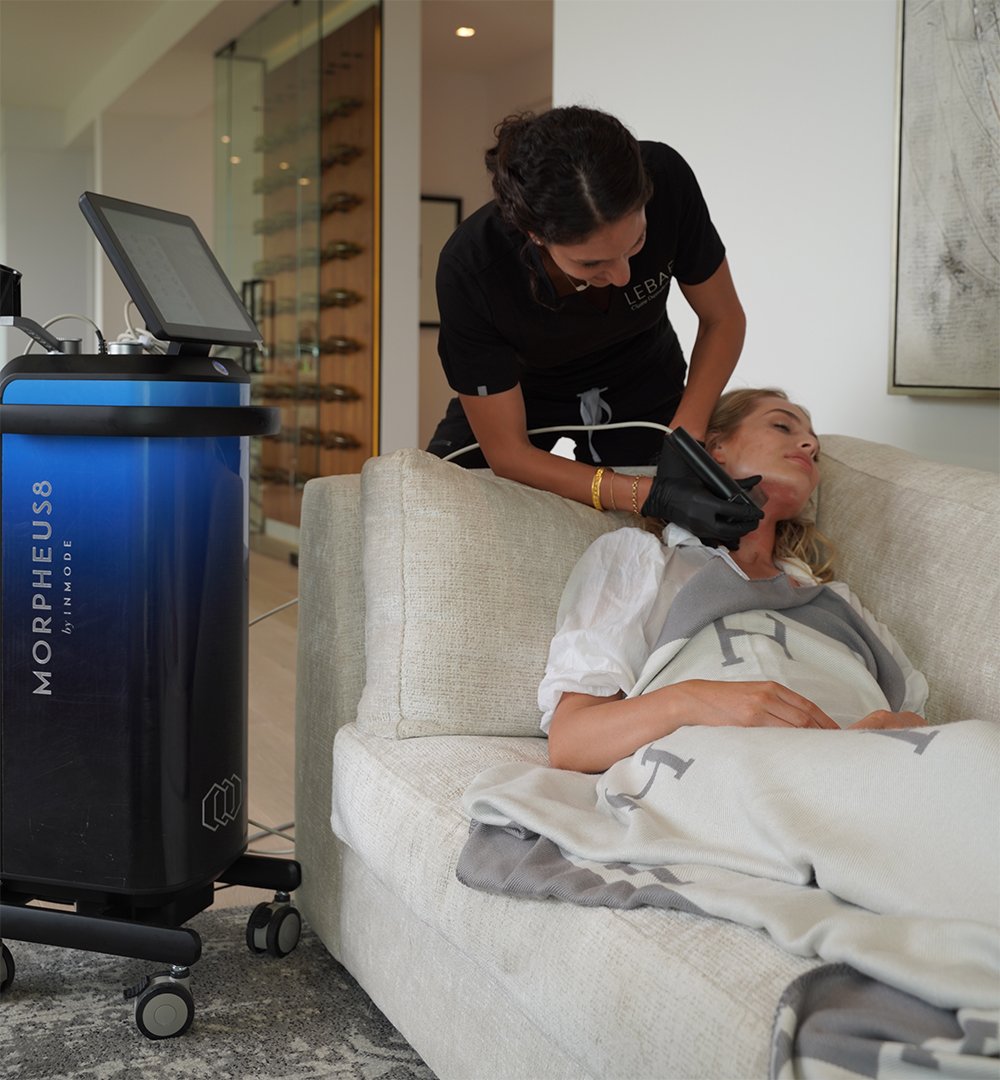 RF Microneedling ( Morpheus 8)