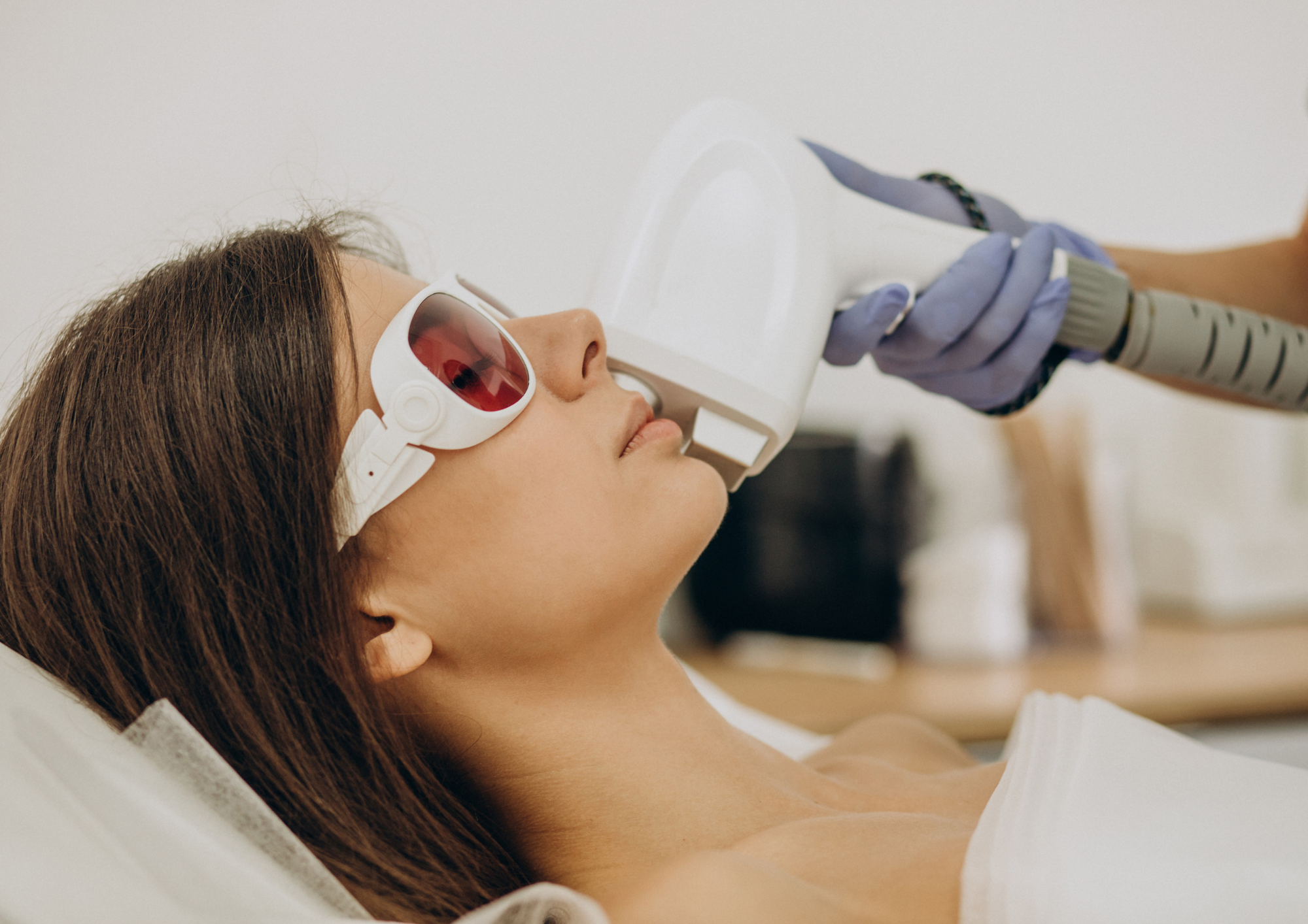 4 Things to Know About Pico Laser Treatment