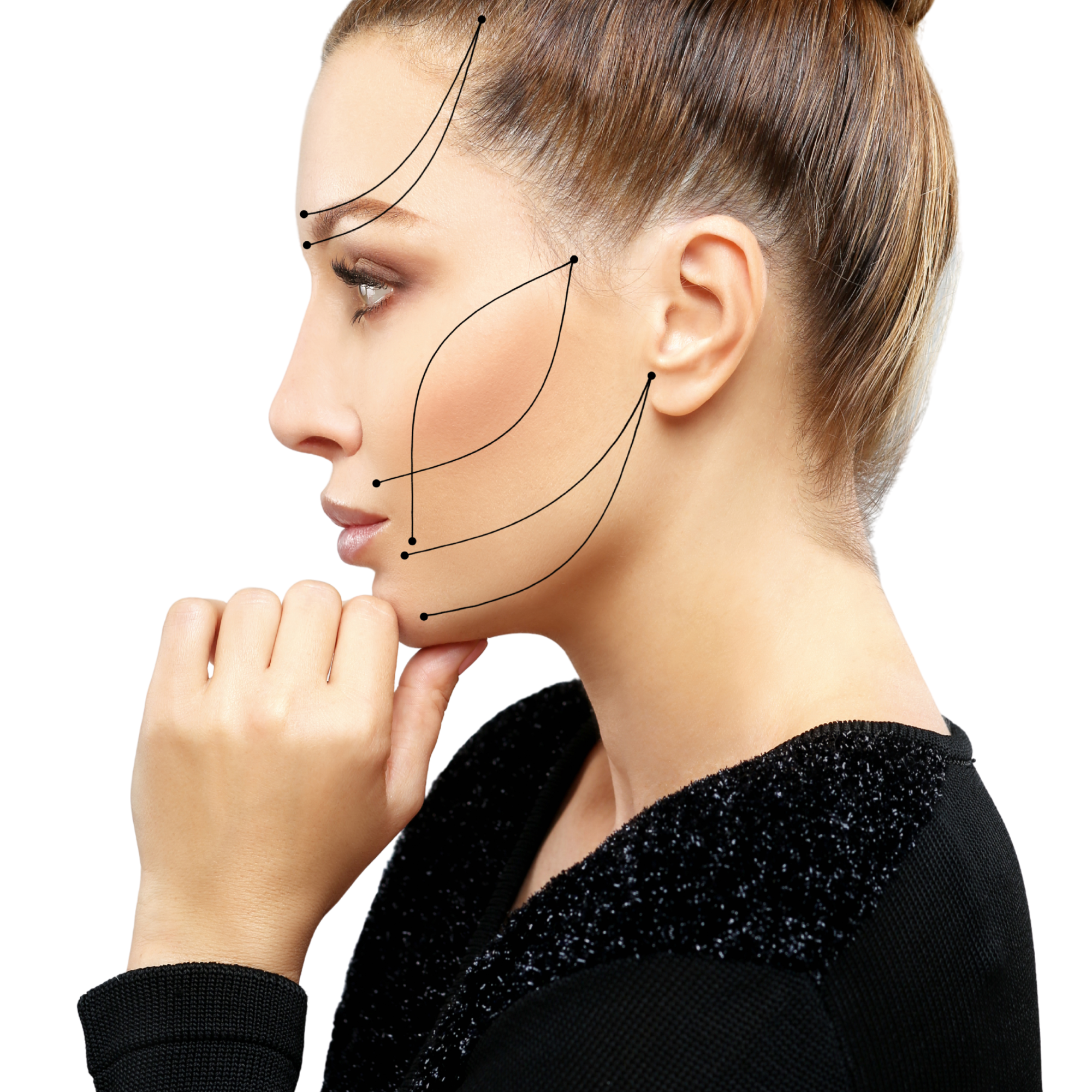 Side profile of a woman with several Lines indicating facial contouring and aesthetic treatment points.