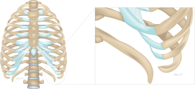 Slipping 10th Rib Mr Nikolaos Panagiotopoulos is leading rib pain/ rib fracture ...