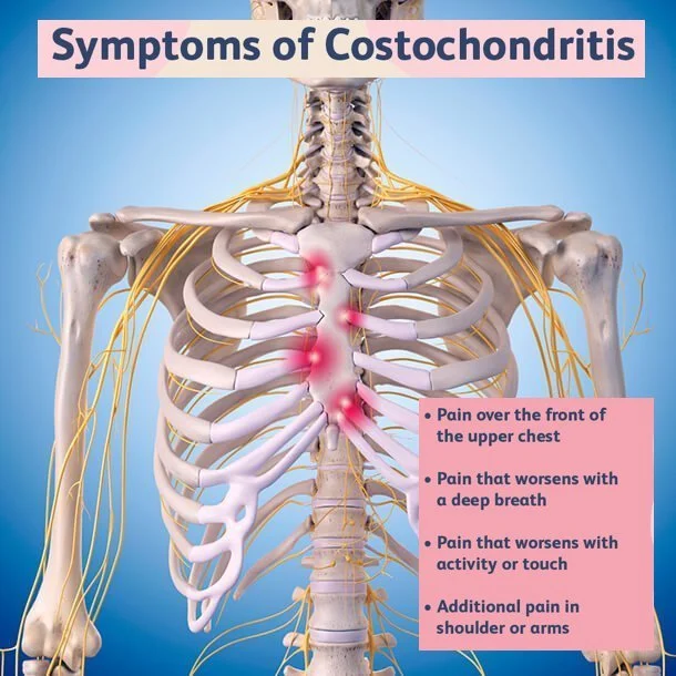 Rib Pain Treatments Costochondritis Innova Pain Clinic Rib Pain Treatments Costochondritis Innova Pain Clinic