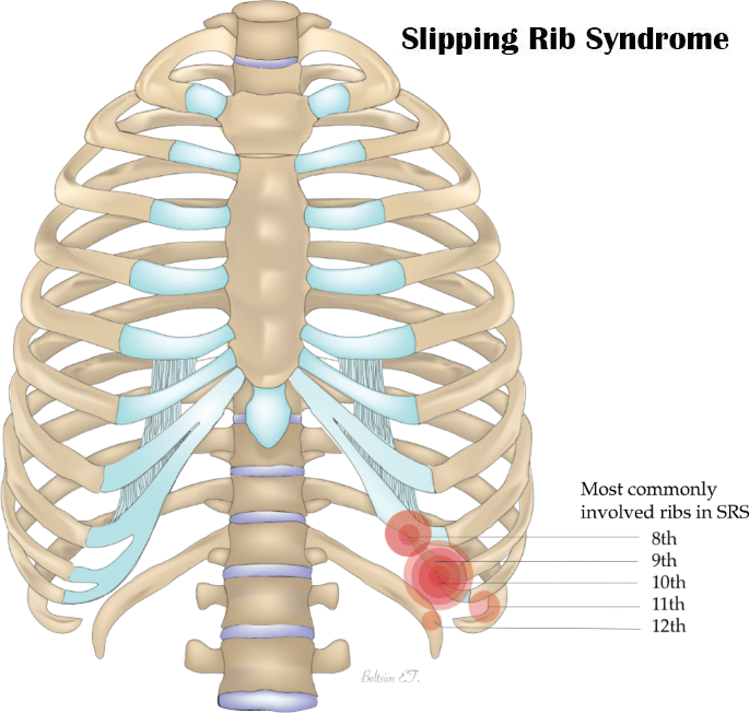 Mr Nikolaos Panagiotopoulos is leading rib pain/ rib fracture ...