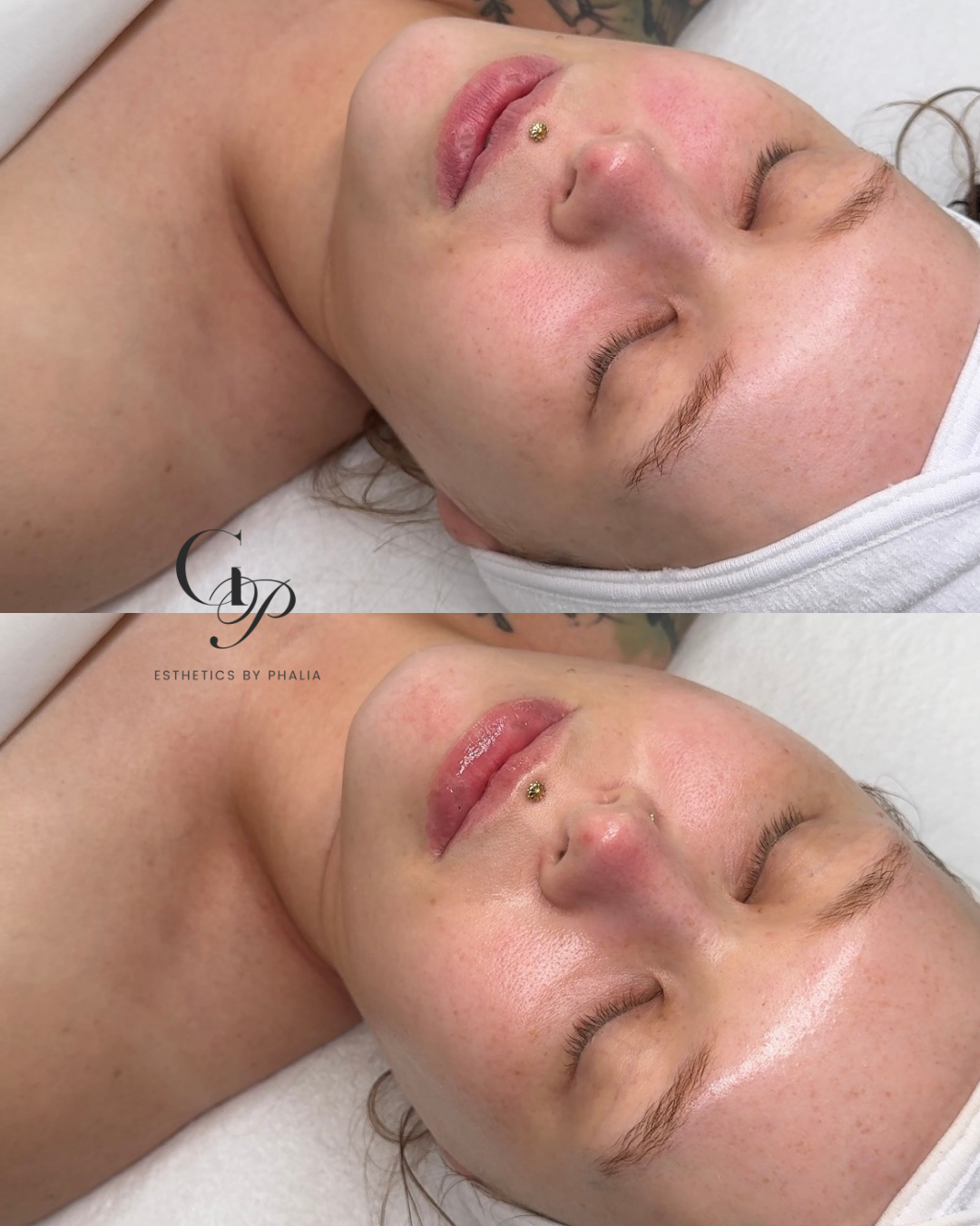 Close-up of a woman with light skin reclined, eyes closed, showing her face and neck, with a gold facial piercing on her upper lip. The second image shows her face with a shiny, wet appearance, likely after a skincare treatment.