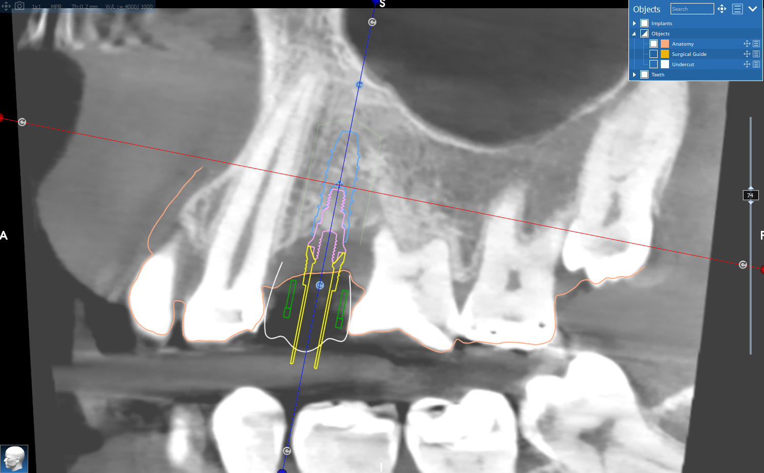 obit t planning2.png