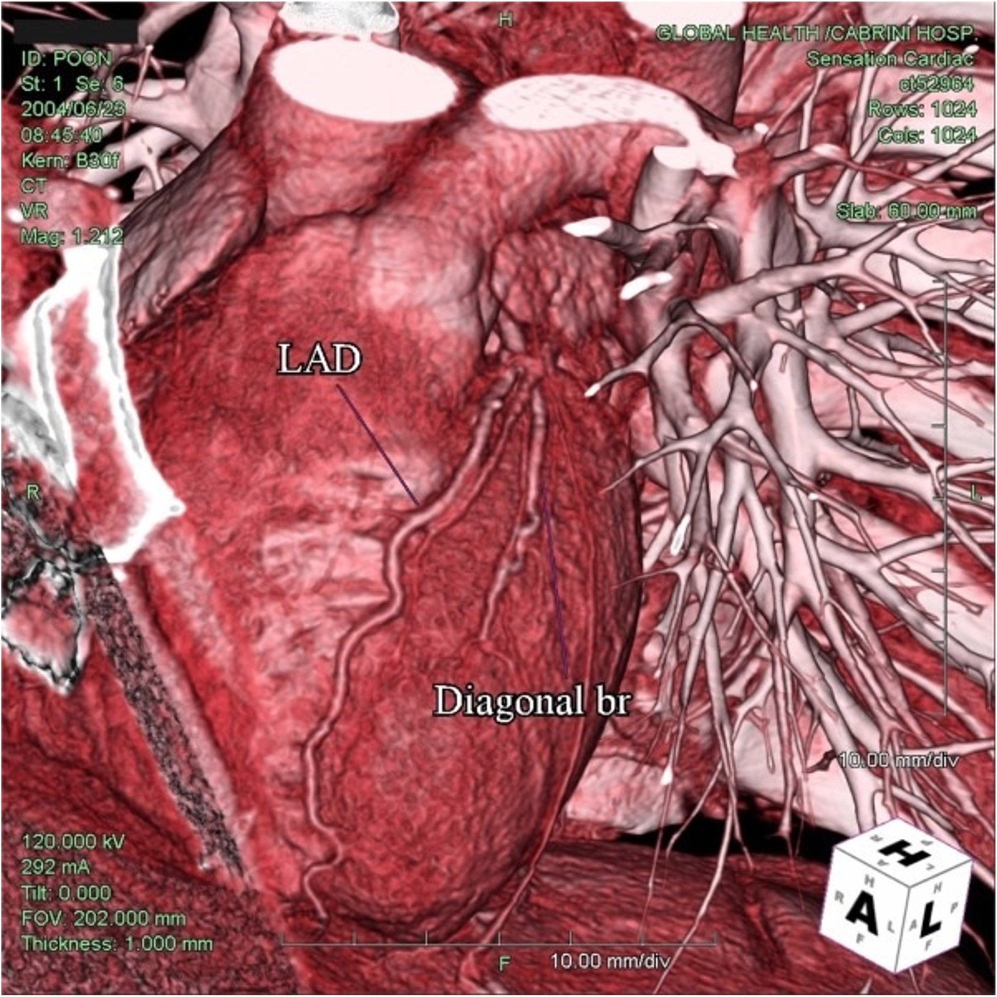TC Heart.jpg