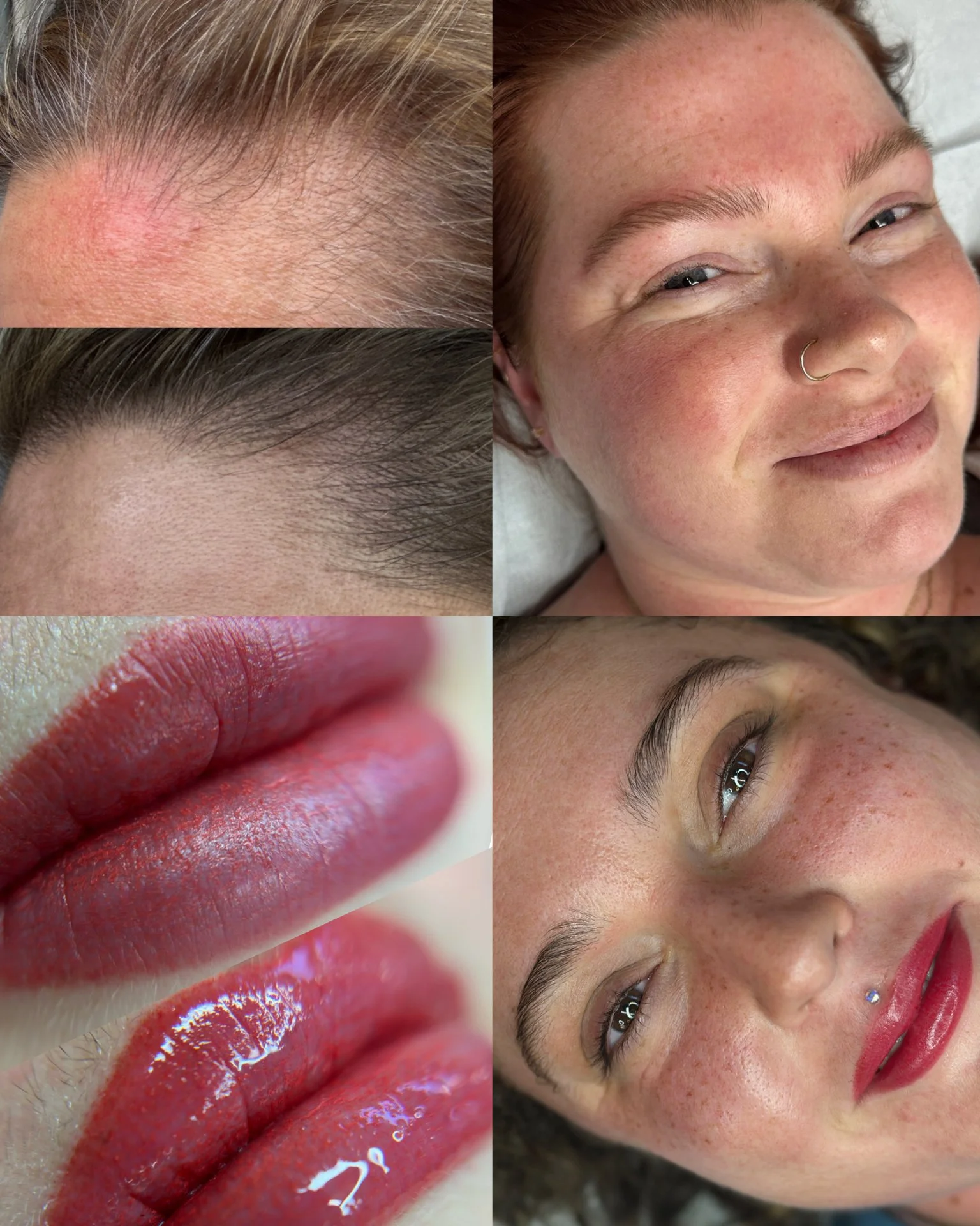 Close-up of a woman with red hair and a nose ring, showing her face with freckles, and two additional close-ups of her eyebrows and lips. The image appears to show cosmetic or skincare procedures.