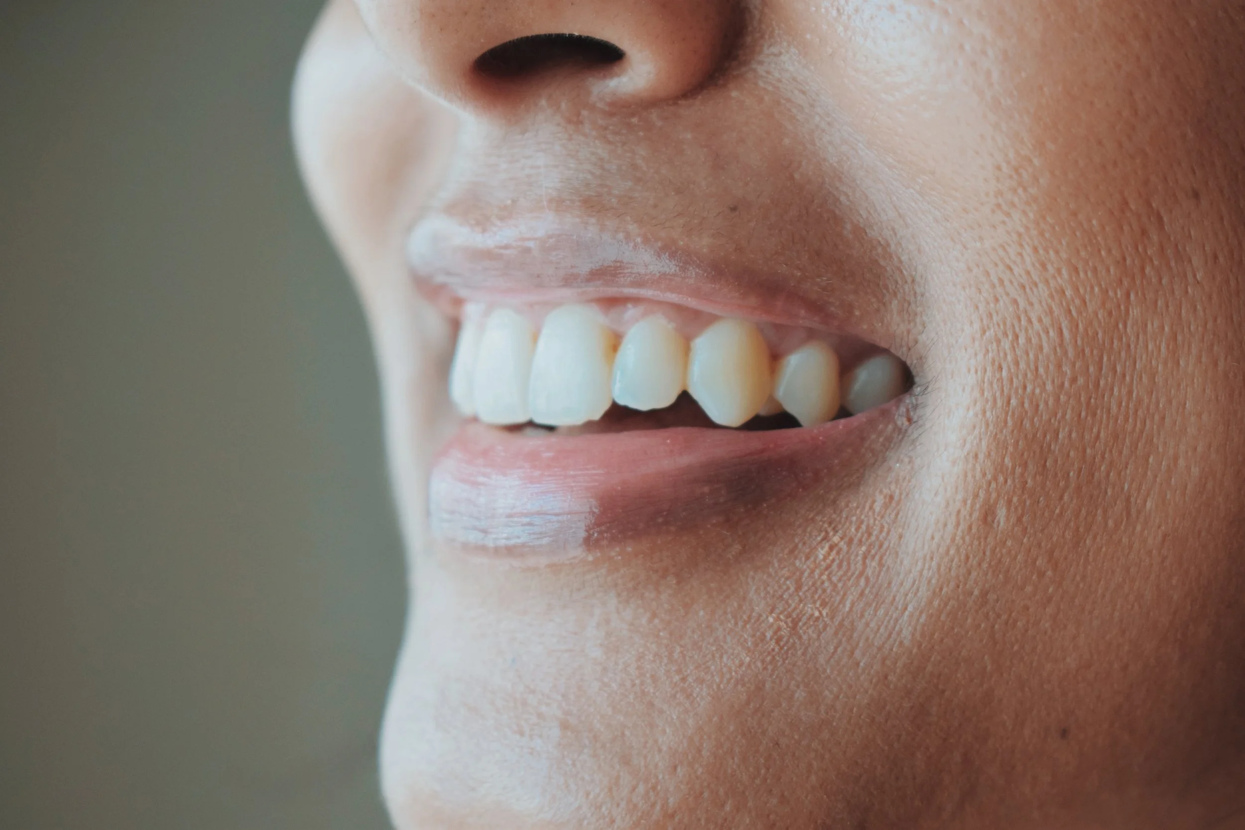 How to Treat “Two-Toned” Lips: Tips From Someone Who Learned to Love Hers