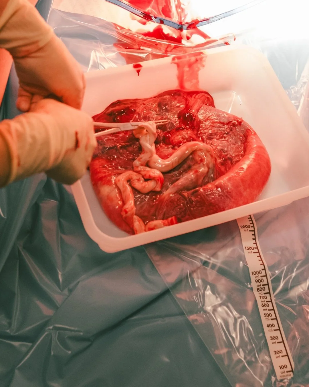 Let&rsquo;s talk about placentas. That incredible organ your body grows just for this one job. Once birth is over, everyone handles it a little differently.

Some people choose to discard it.
Some bury it under a tree or in a special spot.
Some do a 
