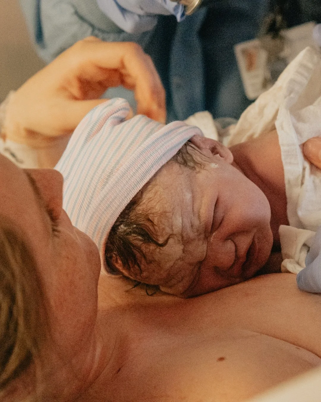 Newborns come into the world looking all kinds of ways, and it is all normal. Some babies are a little swollen from the trip out. Some have long fingers or tiny feet or a head that&rsquo;s a bit cone shaped. Their skin might peel. Their hair might su