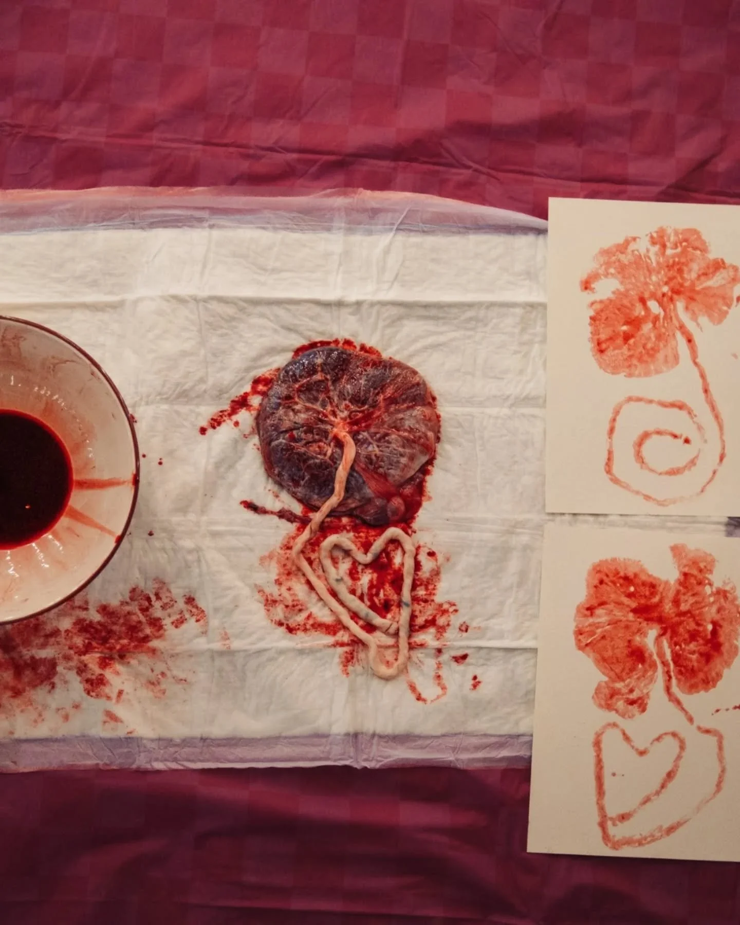 The placenta gets a lot of attention, but it actually works as part of a whole system that supports your baby during pregnancy.

Your baby grows inside the amniotic sac, a thin but strong membrane filled with amniotic fluid. That fluid cushions your 