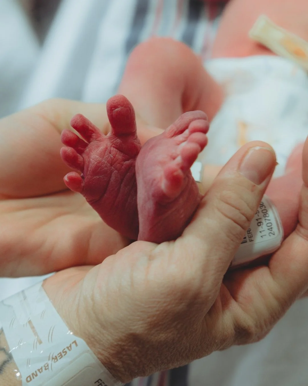 The cutest little toe wrinkles.

Did you know it's very common for babies to have blue/purple/red feet after they are born? As your baby's circulatory system regulates over the next 24-48 hours, the feet will begin to take on a more even skin tone!