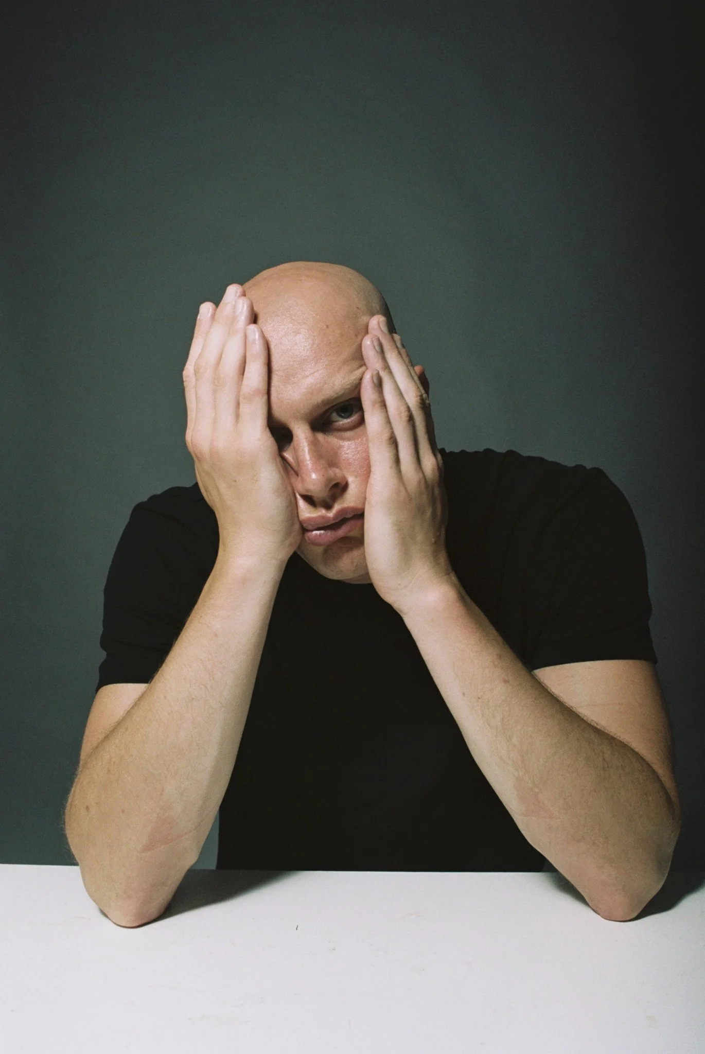 A man with a shaved head wearing a black shirt, resting his head on his hands and looking directly at the camera.