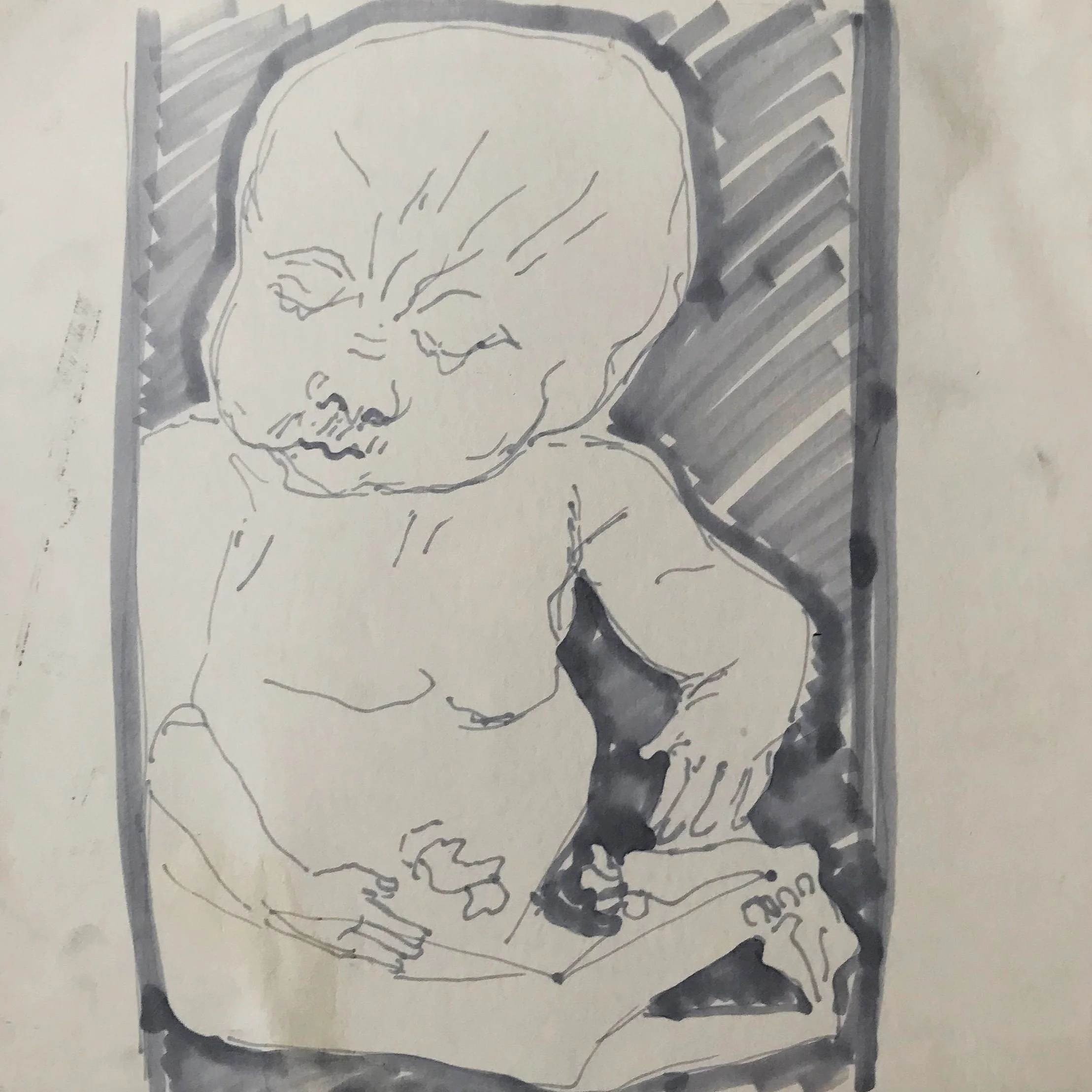 Vrolik Museum, Amsterdam 2018