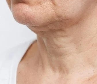 neck.jpeg