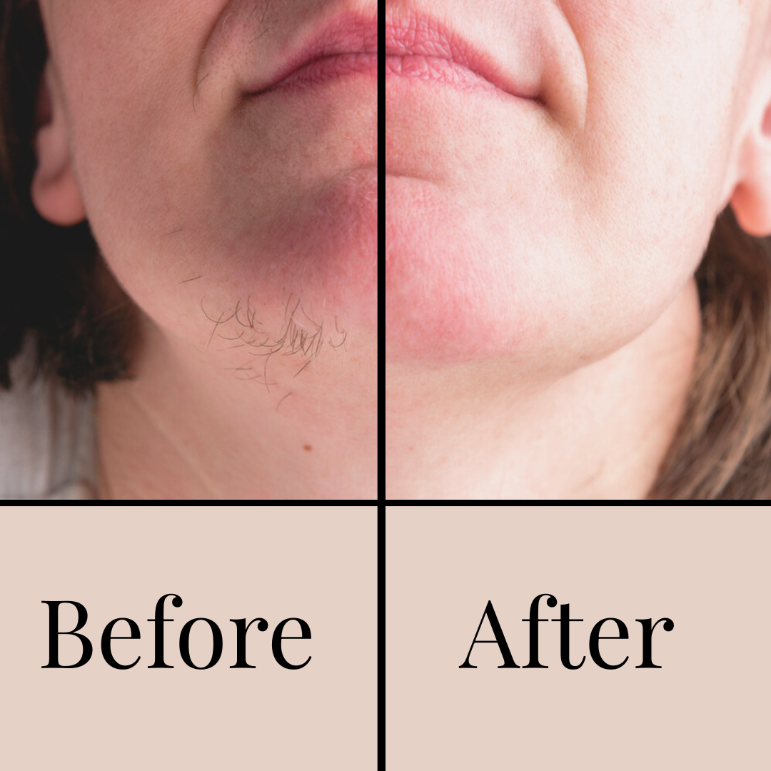 Copy of Copy of Before.png