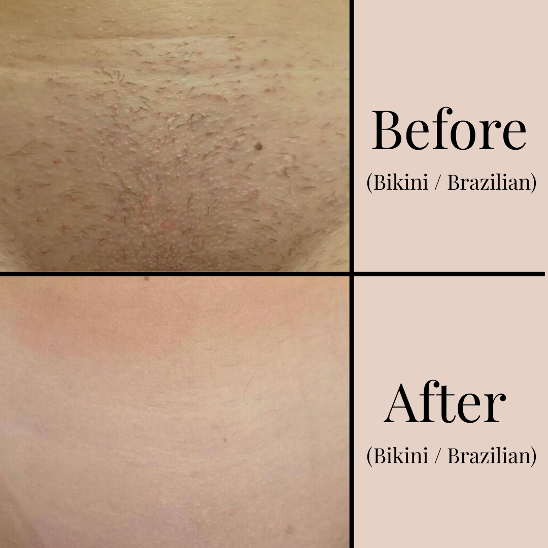 Copy of Copy of Copy of Before.png