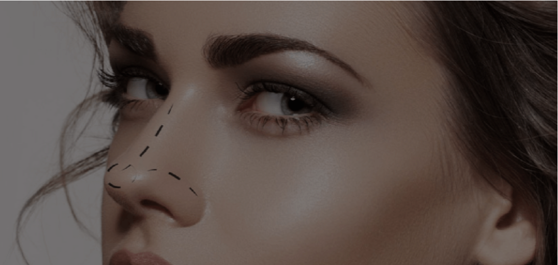 Before You Book a Nose Job: What I Wish Every Patient Knew About Reshaping a Nose Without Surgery