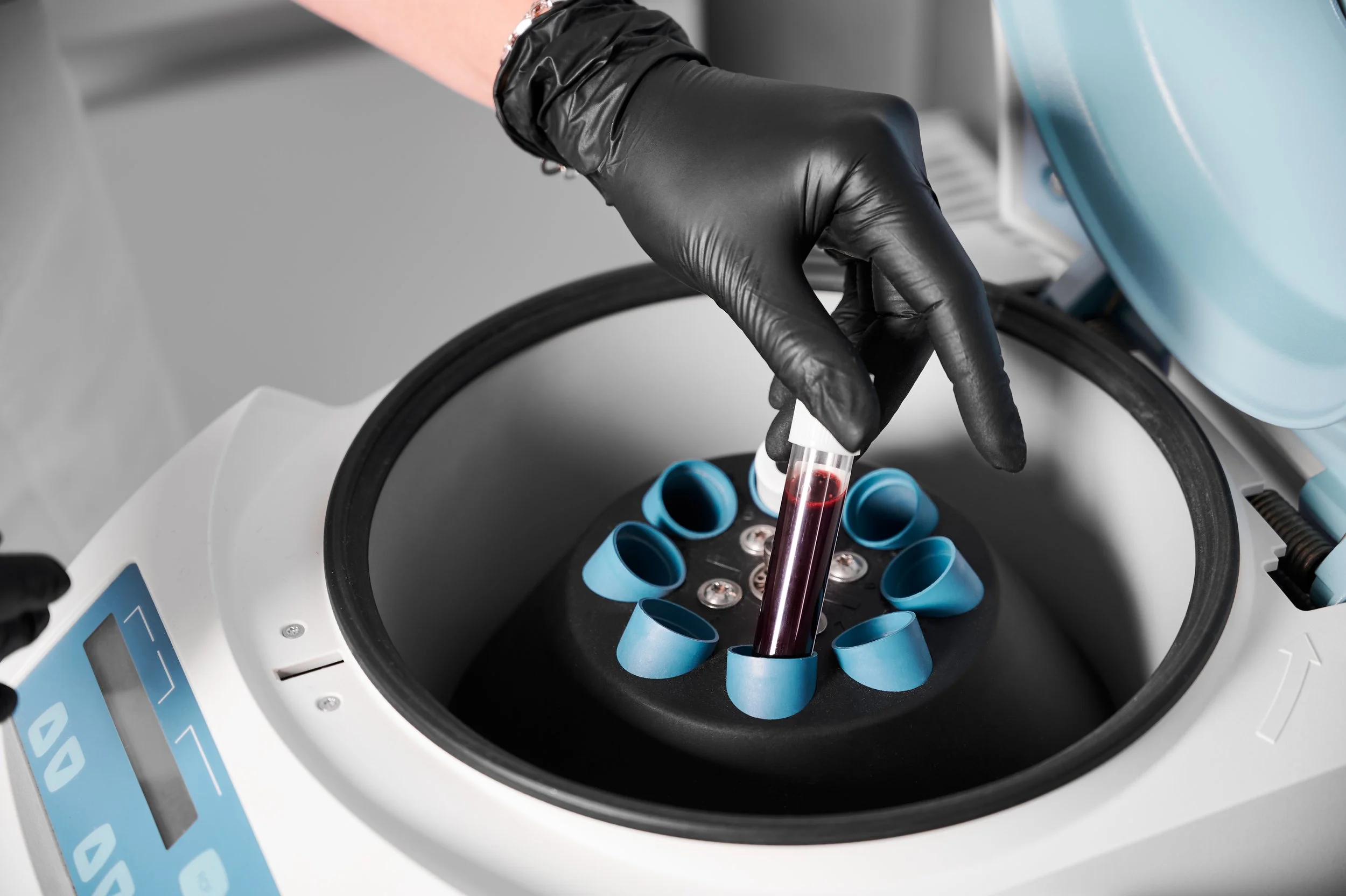Blood sample being placed into a centrifuge to prepare bio filler at Harley Street Injectables