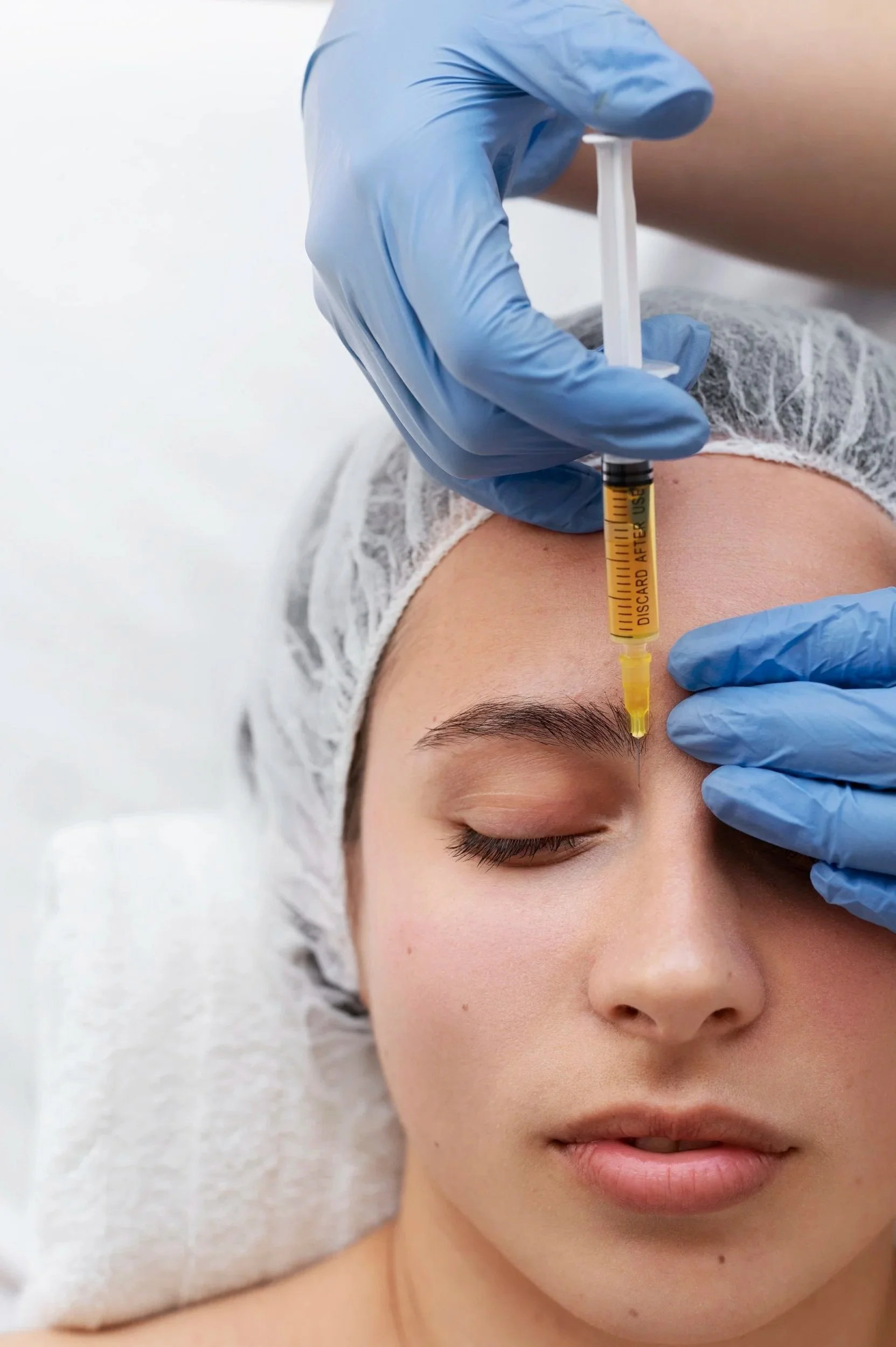 Bio filler being injected into the forehead at Harley Street Injectables, London