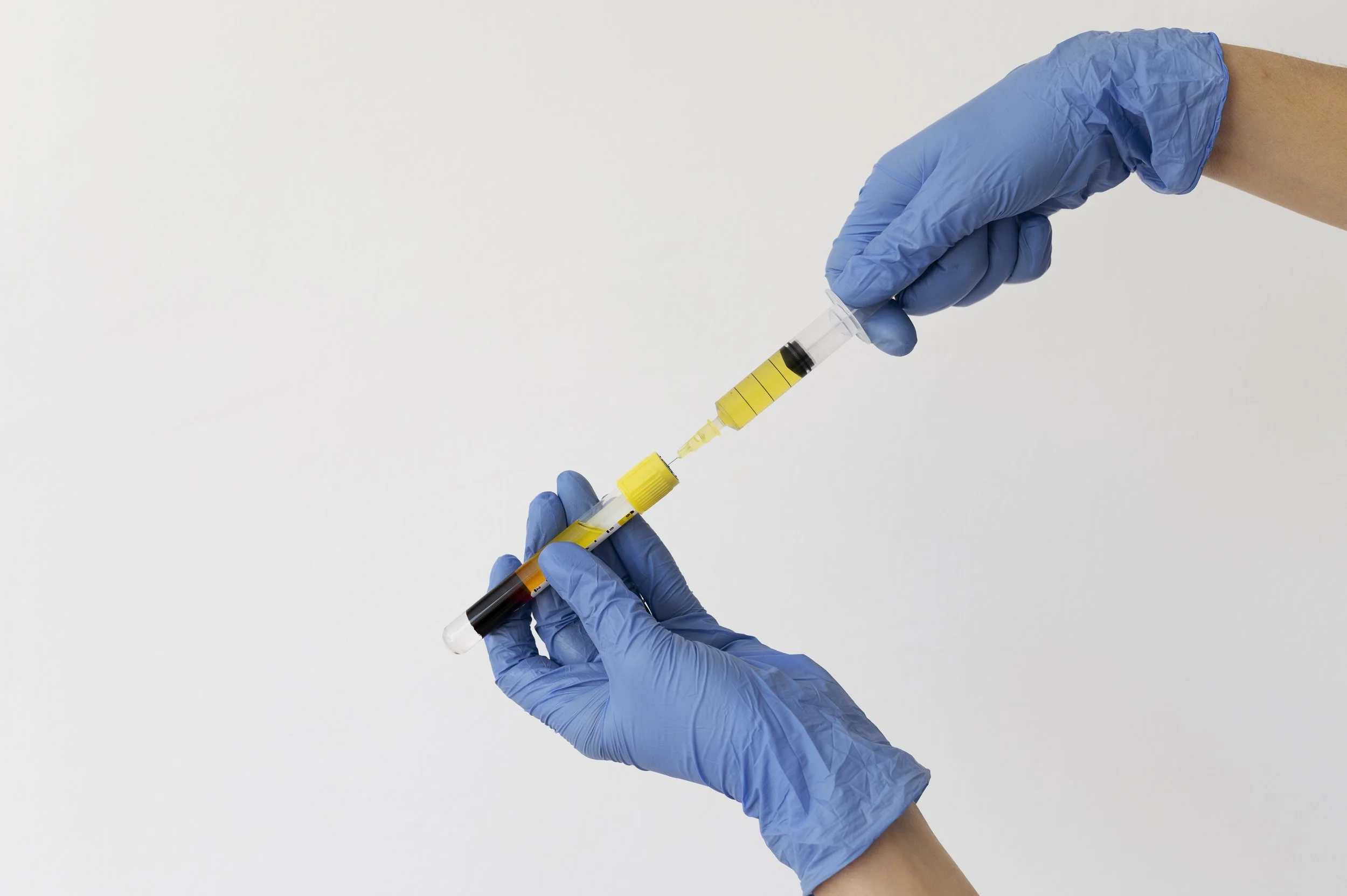 PRP preparation showing platelet-rich plasma separated from a blood sample at Harley Street Injectables
