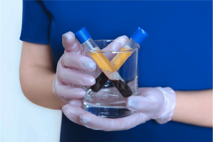 Platelet-Rich-Plasma_1.png