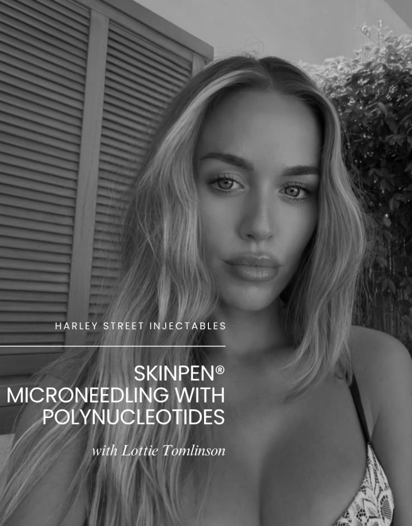 Black-and-white promotional cover image for a SkinPen microneedling treatment video featuring a woman at Harley Street Injectables.