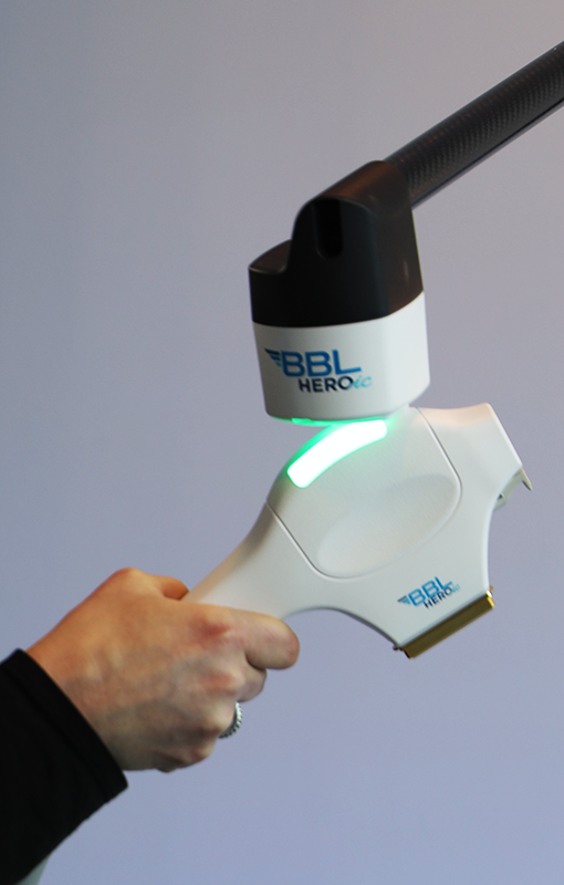 A hand holding a medical device called BBL Hero, which is used for laser skin treatments, with a green light on the tip.