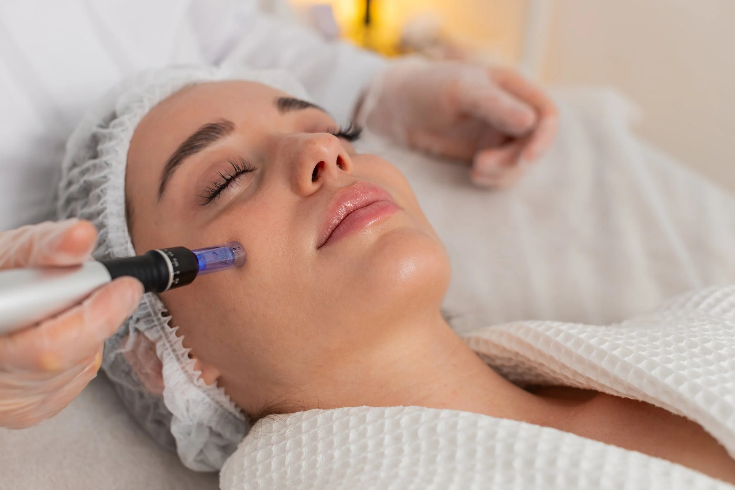 woman receiving microneedling treatment on her face