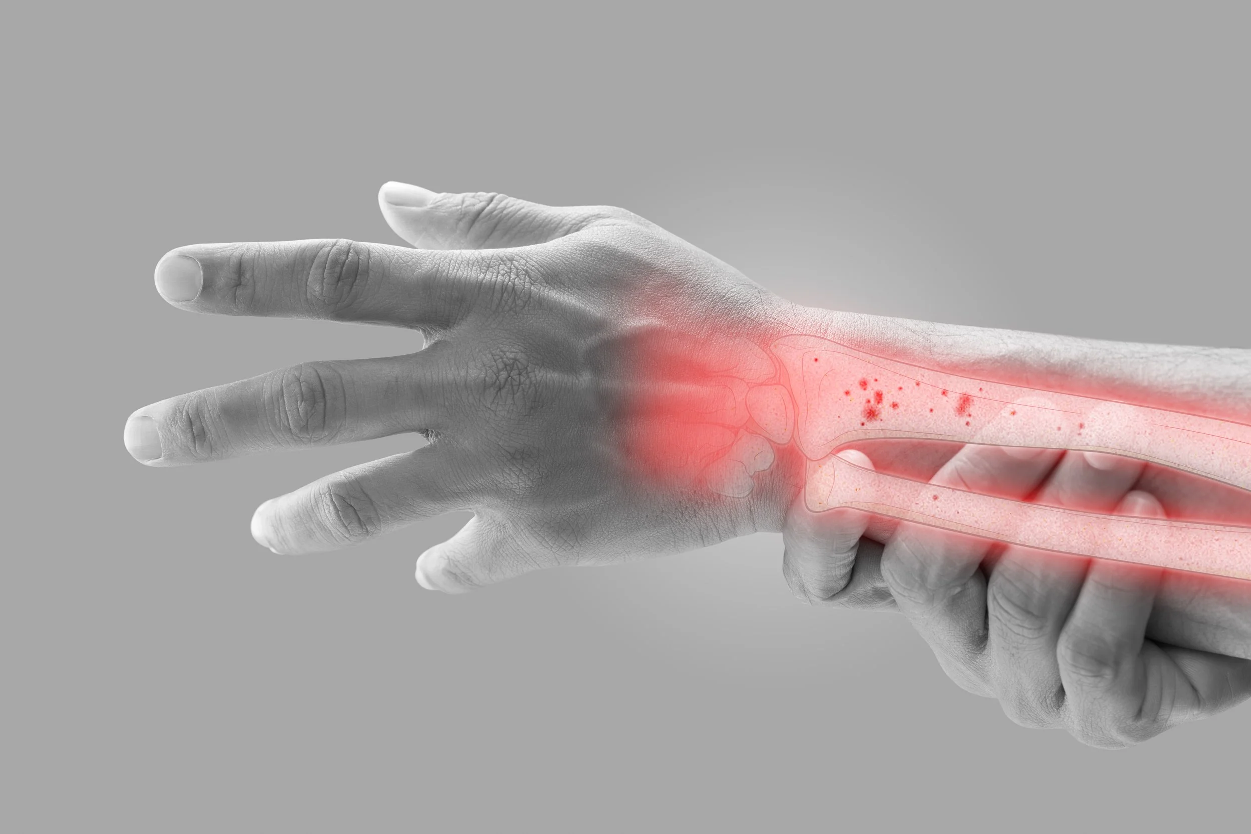Men's Health and Osteoporosis: The Silent Risk Many Men Overlook