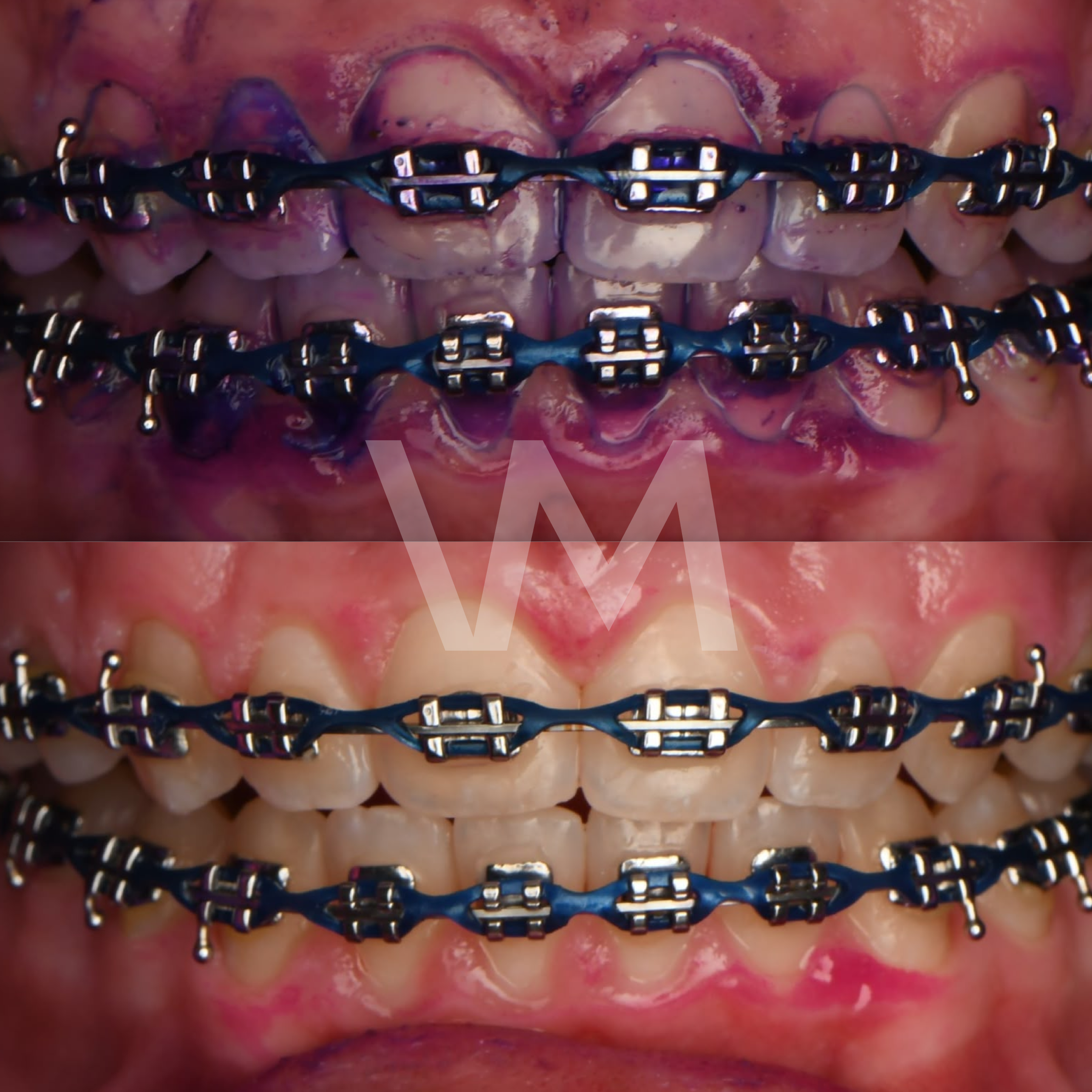 vm-antes-despues-web-38.png