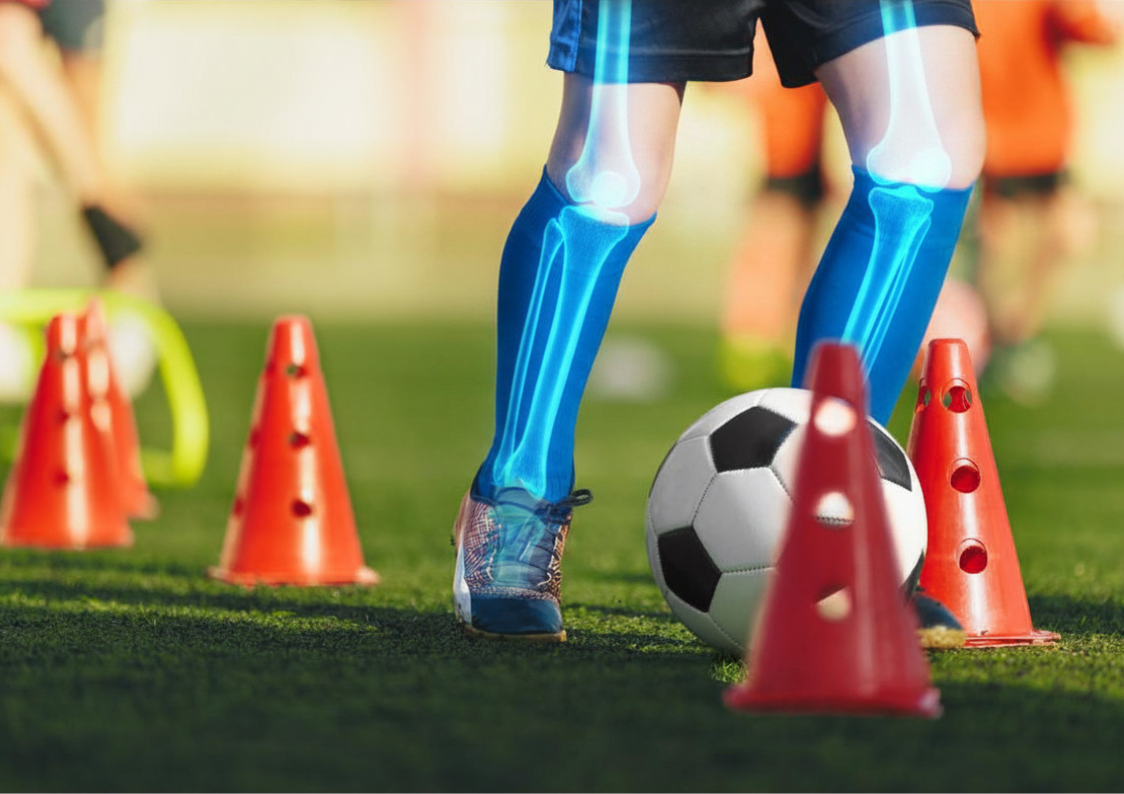 Building Stronger Bones for Life: Why Childhood Football Matters More Than You Think
